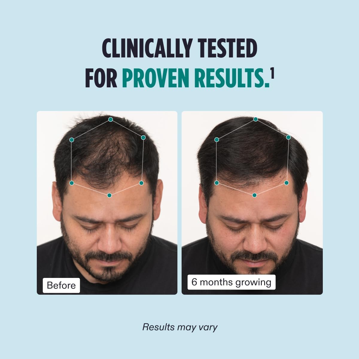 Nutrafol Men's Hair-2-Month Supply